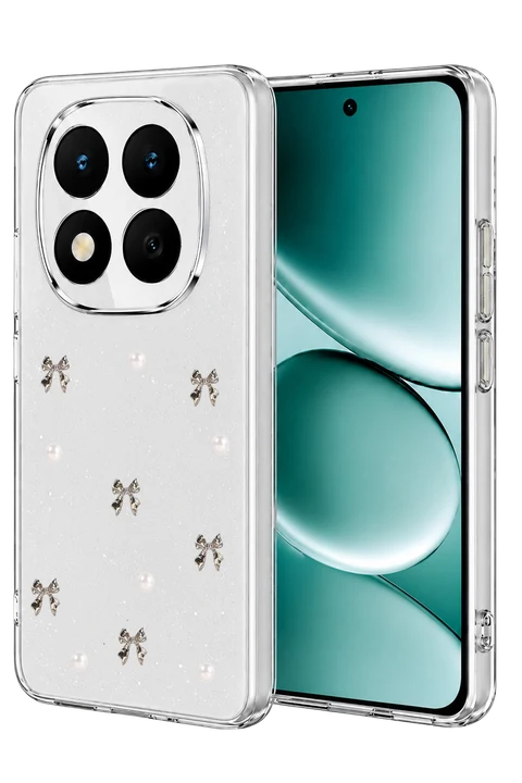 uryport Xiaomi Redmi Note 15 Pro 4G Fiyonk Desenli Kapak - Desen 8