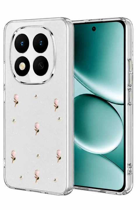 uryport Xiaomi Redmi Note 15 Pro 4G Fiyonk Desenli Kapak - Desen 6