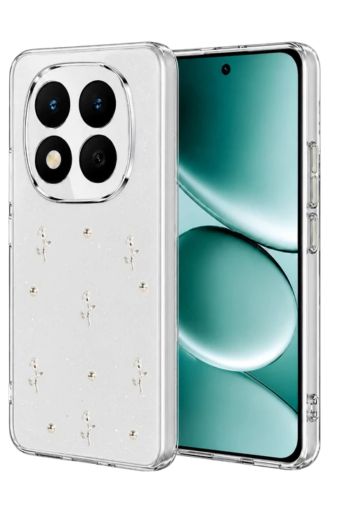 uryport Xiaomi Redmi Note 15 Pro 4G Fiyonk Desenli Kapak - Desen 4